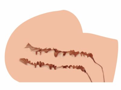 sx3477-46954420009850